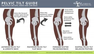 Posterior-Anterior-Pelvic-Tilt-and-Swayback2