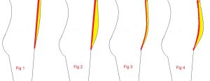 pelvis-2