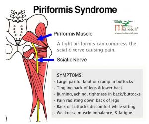 15fffd5675ad83bb31c1f4c8a98db97c--stretching-sciatica-relief