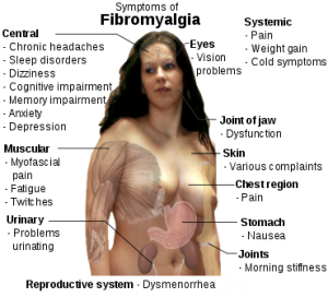 Fibromyalgia_symptoms.svg