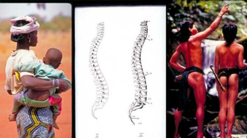 posture analysis